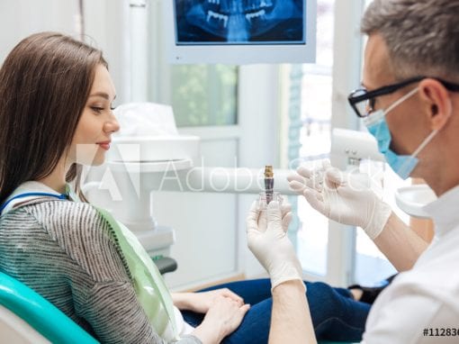 Dental Implants